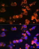 Anti-GLUT2/SLC2A2 antibody produced in rabbit