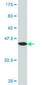 Monoclonal Anti-S100A7 antibody produced in mouse clone 2A10, purified immunoglobulin, buffered aqueous solution