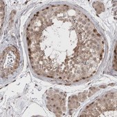 Anti-EXOSC4 antibody produced in rabbit Prestige Antibodies&#174; Powered by Atlas Antibodies, affinity isolated antibody, buffered aqueous glycerol solution