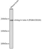 Anti-Integrin beta 4 (ITGB4/CD104) Antibody, clone 5Z9P3, Rabbit Monoclonal