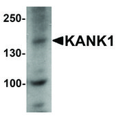 Anti-KANK1 antibody produced in rabbit affinity isolated antibody, buffered aqueous solution