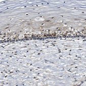 Anti-COL1A1 antibody produced in rabbit Prestige Antibodies® Powered by Atlas Antibodies, affinity isolated antibody, buffered aqueous glycerol solution