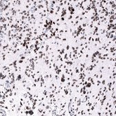 Monoclonal Anti-EZH2 antibody produced in mouse Prestige Antibodies® Powered by Atlas Antibodies, clone CL11960, purified immunoglobulin, buffered aqueous glycerol solution