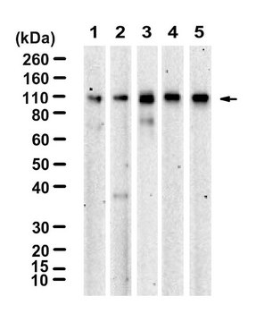 Anti-CTNND1/p120CTN Antibody, clone 2C22 ZooMAb&#174; Rabbit Monoclonal recombinant, expressed in HEK 293 cells