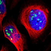 Anti-ZSCAN1 antibody produced in rabbit Prestige Antibodies&#174; Powered by Atlas Antibodies, affinity isolated antibody, buffered aqueous glycerol solution