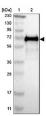 Anti-SPINT1 antibody produced in rabbit Prestige Antibodies&#174; Powered by Atlas Antibodies, affinity isolated antibody, buffered aqueous glycerol solution
