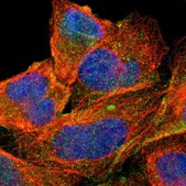 Anti-ABCC1 antibody produced in rabbit Prestige Antibodies® Powered by Atlas Antibodies, affinity isolated antibody, buffered aqueous glycerol solution, Ab1