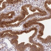 Anti-PEX14 antibody produced in rabbit Prestige Antibodies&#174; Powered by Atlas Antibodies, affinity isolated antibody, buffered aqueous glycerol solution