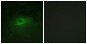 Anti-CSFR antibody produced in rabbit affinity isolated antibody
