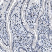 Anti-CNP antibody produced in rabbit Prestige Antibodies&#174; Powered by Atlas Antibodies, affinity isolated antibody, buffered aqueous glycerol solution, Ab1