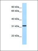 Anti-SLC25A28 antibody produced in rabbit affinity isolated antibody