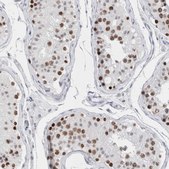 Anti-SMARCC1 antibody produced in rabbit Prestige Antibodies&#174; Powered by Atlas Antibodies, affinity isolated antibody, buffered aqueous glycerol solution