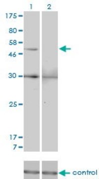 Monoclonal Anti-MMP13 antibody produced in mouse clone 3B11, purified immunoglobulin, buffered aqueous solution