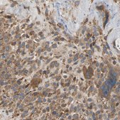 Anti-LIMK2 antibody produced in rabbit Prestige Antibodies&#174; Powered by Atlas Antibodies, affinity isolated antibody, buffered aqueous glycerol solution