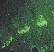 Anti-Neural Cell Adhesion Molecule Antibody Chemicon&#174;, from rabbit