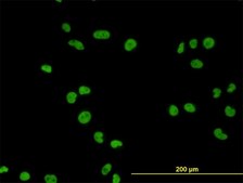 Monoclonal Anti-MCM7 antibody produced in mouse clone 6C2, purified immunoglobulin, buffered aqueous solution