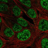 Anti-PLAG1 antibody produced in rabbit Prestige Antibodies&#174; Powered by Atlas Antibodies, affinity isolated antibody