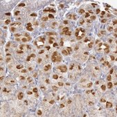 Anti-PIK3R1 antibody produced in rabbit Ab1, Prestige Antibodies® Powered by Atlas Antibodies, affinity isolated antibody, buffered aqueous glycerol solution