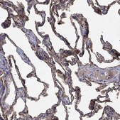 Anti-AGER antibody produced in rabbit Prestige Antibodies&#174; Powered by Atlas Antibodies, affinity isolated antibody, buffered aqueous glycerol solution