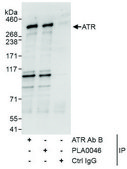 Rabbit anti-ATR Antibody, Affinity Purified Powered by Bethyl Laboratories, Inc.