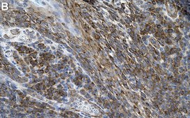 Anti-Lyn Antibody, clone 1E23 ZooMAb&#174; Rabbit Monoclonal recombinant, expressed in HEK 293 cells