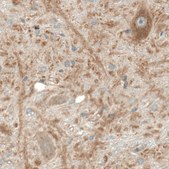 Anti-VPS35 antibody produced in rabbit Prestige Antibodies&#174; Powered by Atlas Antibodies, affinity isolated antibody, buffered aqueous glycerol solution