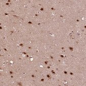 Anti-PSMC5 antibody produced in rabbit Prestige Antibodies&#174; Powered by Atlas Antibodies, affinity isolated antibody