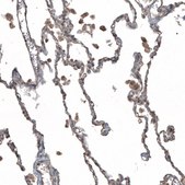 Anti-PLAUR antibody produced in rabbit Prestige Antibodies&#174; Powered by Atlas Antibodies, affinity isolated antibody, buffered aqueous glycerol solution