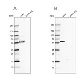 Anti-FTCD antibody produced in rabbit Prestige Antibodies&#174; Powered by Atlas Antibodies, affinity isolated antibody, buffered aqueous glycerol solution