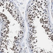 Anti-LRWD1 antibody produced in rabbit Prestige Antibodies&#174; Powered by Atlas Antibodies, affinity isolated antibody, buffered aqueous glycerol solution