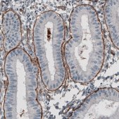 Monoclonal Anti-LAMC1 antibody produced in mouse Prestige Antibodies&#174; Powered by Atlas Antibodies, clone CL3196, purified immunoglobulin, buffered aqueous glycerol solution