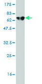 Monoclonal Anti-ALDOA antibody produced in mouse clone 3D9-6F3, purified immunoglobulin, buffered aqueous solution