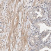 Anti-MPRIP antibody produced in rabbit Prestige Antibodies&#174; Powered by Atlas Antibodies, affinity isolated antibody, buffered aqueous glycerol solution, Ab1