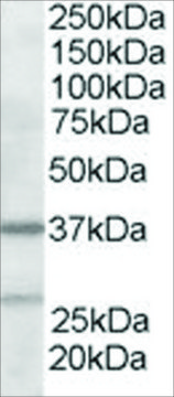 Anti-ARP2/3 subunit 1B antibody produced in goat affinity isolated antibody, buffered aqueous solution