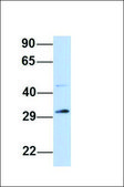 Anti-TP53 (ab3) antibody produced in rabbit affinity isolated antibody