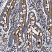 Anti-NT5E antibody produced in rabbit Prestige Antibodies&#174; Powered by Atlas Antibodies, affinity isolated antibody, buffered aqueous glycerol solution