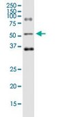Monoclonal Anti-ODC1 antibody produced in mouse clone 2G5, purified immunoglobulin, buffered aqueous solution