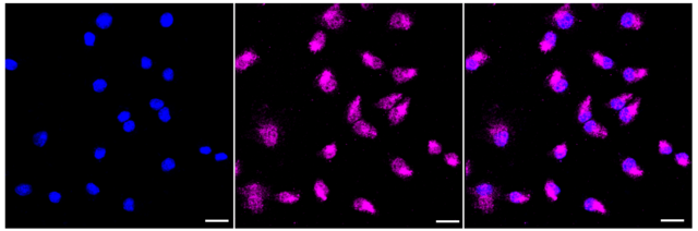 KD-Validated Anti TAR DNA binding protein Antibody, clone 23GB4730, Rabbit Monoclonal clone 23GB4730, recombinant rabbit monoclonal, expressed in HEK293 cells