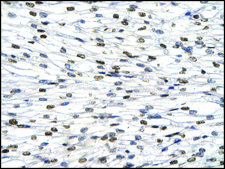 Anti-HES1 IgG fraction of antiserum