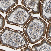Anti-VAPB antibody produced in rabbit Prestige Antibodies&#174; Powered by Atlas Antibodies, affinity isolated antibody, buffered aqueous glycerol solution