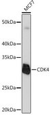 Anti- CDK4 antibody produced in rabbit