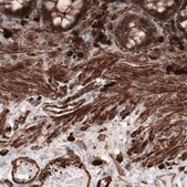 Monoclonal Anti-ACTB antibody produced in mouse Prestige Antibodies&#174; Powered by Atlas Antibodies, clone CL3868, purified immunoglobulin, buffered aqueous glycerol solution