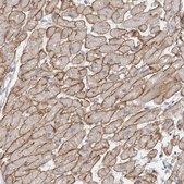 Anti-DMD antibody produced in rabbit Prestige Antibodies&#174; Powered by Atlas Antibodies, affinity isolated antibody, buffered aqueous glycerol solution