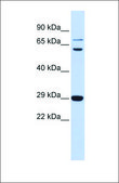 Anti-CD40LG antibody produced in rabbit affinity isolated antibody