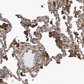 Anti-LIF antibody produced in rabbit Prestige Antibodies&#174; Powered by Atlas Antibodies, affinity isolated antibody, buffered aqueous glycerol solution