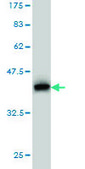 Monoclonal Anti-PRKCD antibody produced in mouse clone 2E12, purified immunoglobulin, buffered aqueous solution