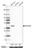 Anti-SERPINB5 antibody produced in rabbit Prestige Antibodies&#174; Powered by Atlas Antibodies, affinity isolated antibody, buffered aqueous glycerol solution