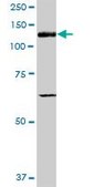 Anti-ITGAV antibody produced in mouse purified immunoglobulin, buffered aqueous solution