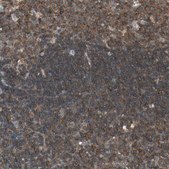 Anti-TEC antibody produced in rabbit Prestige Antibodies® Powered by Atlas Antibodies, affinity isolated antibody, buffered aqueous glycerol solution