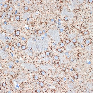 Anti-GOT2 antibody produced in rabbit